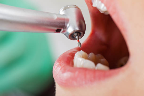 Best Mobile Emergency Dentist in Middletown, DE